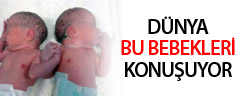 Dünya bu bebekleri konuşuyor