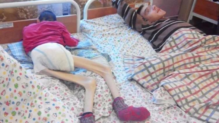 Dehşet verici kareler! Açlıktan ölmek üzereler galerisi resim 1