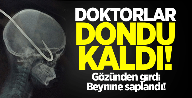 Gözünden girdi! Beynine saplandı
