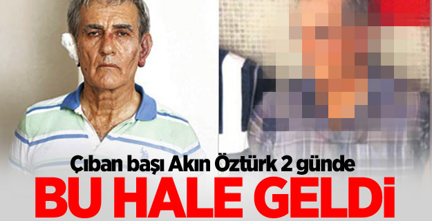 Akın Öztürk iki günde bu hale geldi