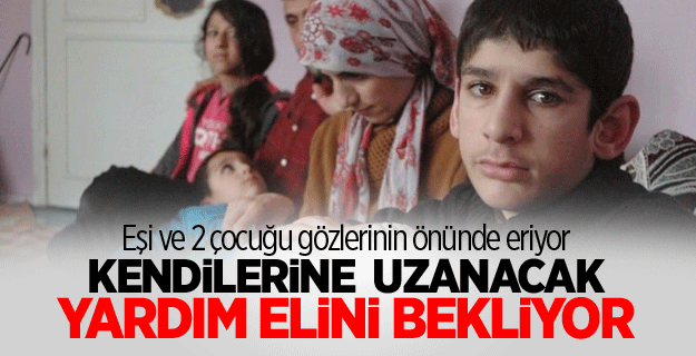Eşi ve 2 çocuğu gözlerinin önünde eriyor