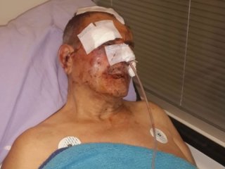 Komşusundan aidat istedi hastanelik oldu
