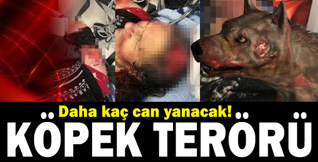 Daha kaç can yanacak!