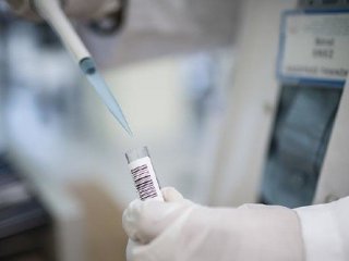 Genetik hastalıklarda tanı süresini 20 günden 1 saate indirdi