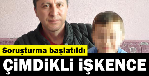 Otizmli çocuğa kreşte 'çimdikli' işkence iddiası
