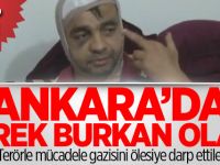 Başkent’te gazi ve kardeşine çirkin saldırı