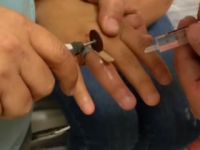 Parmağında sıkışan yüzüğü itfaiye çıkardı