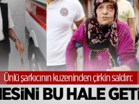 Ünlü şarkıcının kuzeninden çirkin saldırı