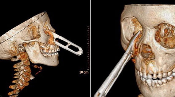 2.20140312163851.jpg 2.20140312163851.jpg