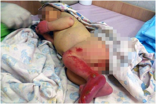 bebek,,.jpg bebek,,.jpg