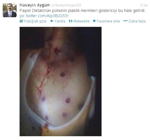 chp_li_vekil_suriye_askerinin_vurdugu_cocugu_4737236_ojpg_h199.jpg chp_li_vekil_suriye_askerinin_vurdugu_cocugu_4737236_ojpg_h199.jpg