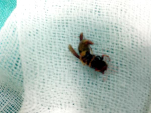 kulak-ari-kene-sadecehaber.jpg kulak-ari-kene-sadecehaber.jpg