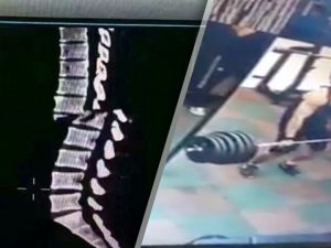 Spor salonunda omuriliğini böyle kırdı!